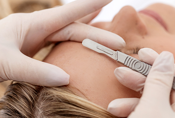 Dermaplaning