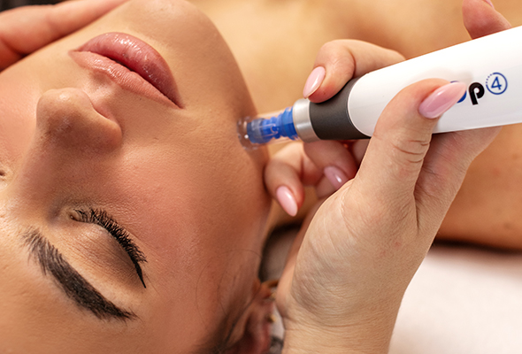 Microneedling